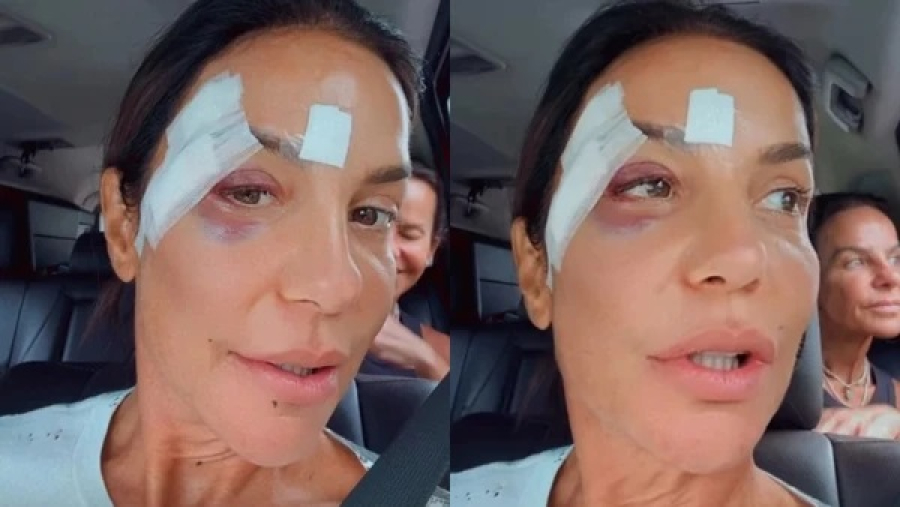 Ivete Sangalo abre o jogo e fala pela primeira vez sobre rumores de agressão